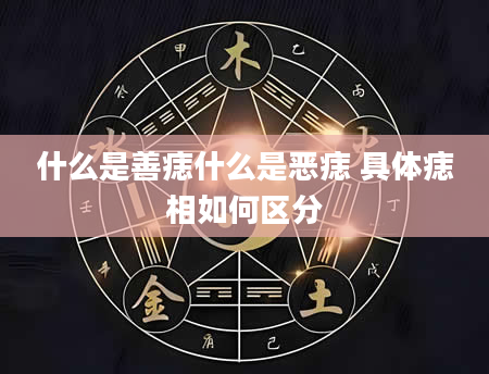 什么是善痣什么是恶痣 具体痣相如何区分