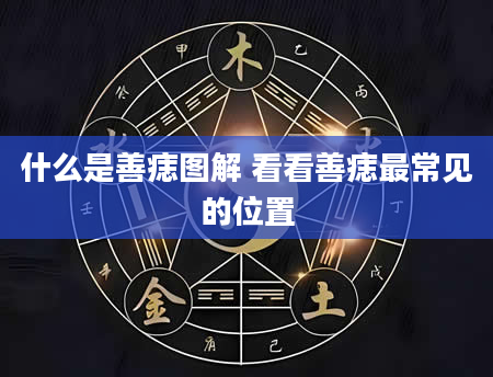 什么是善痣图解 看看善痣最常见的位置