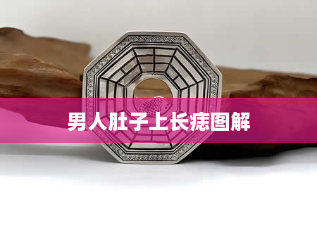男人肚子上长痣图解