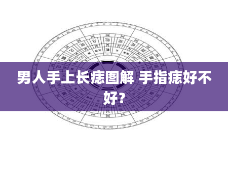 男人手上长痣图解 手指痣好不好？