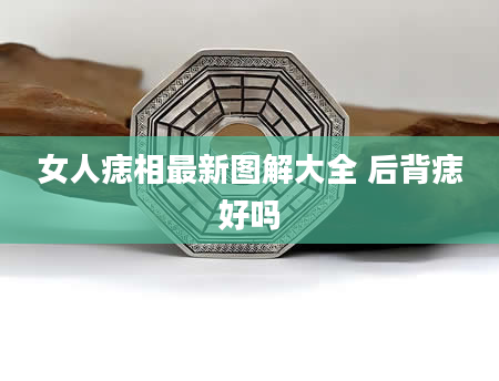 女人痣相最新图解大全 后背痣好吗