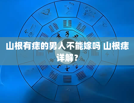 山根有痣的男人不能嫁吗 山根痣详解？