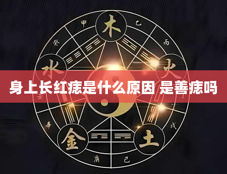 身上长红痣是什么原因 是善痣吗