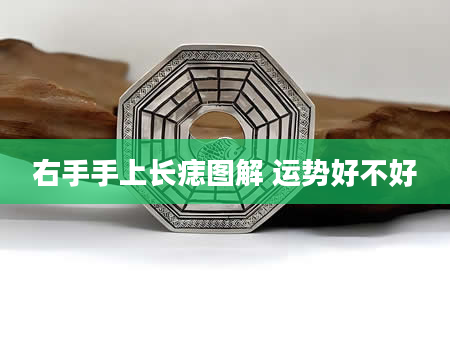 右手手上长痣图解 运势好不好