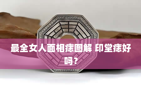 最全女人面相痣图解 印堂痣好吗？
