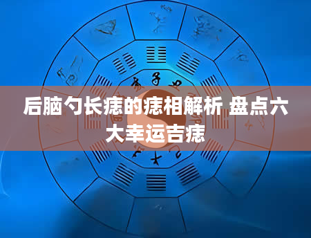 后脑勺长痣的痣相解析 盘点六大幸运吉痣