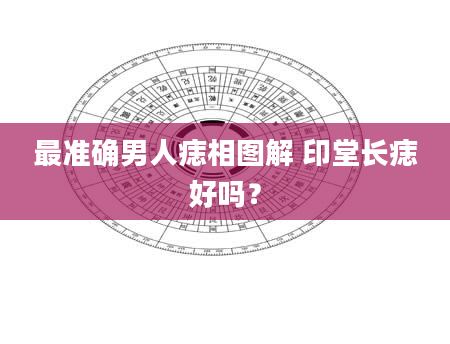 最准确男人痣相图解 印堂长痣好吗?
