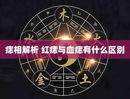 痣相解析 红痣与血痣有什么区别